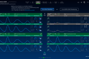 SSEP Baselines Set Detailed View