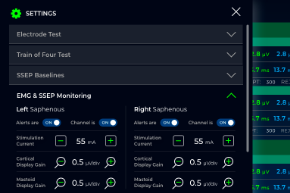 SSEP and EMG Monitoring Settings