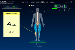 Triggered EMG Monitoring via Clip or Probe